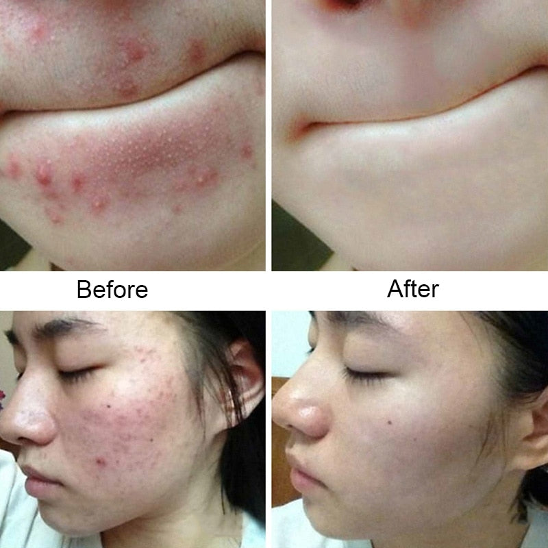 Sea Salt Soap Natural Advanced Wash Skin Whitening Soap
