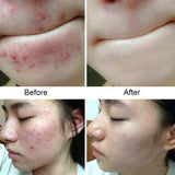 Sea Salt Soap Natural Advanced Wash Skin Whitening Soap
