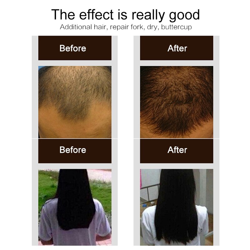 Purc 30ml Hair Growth Spray