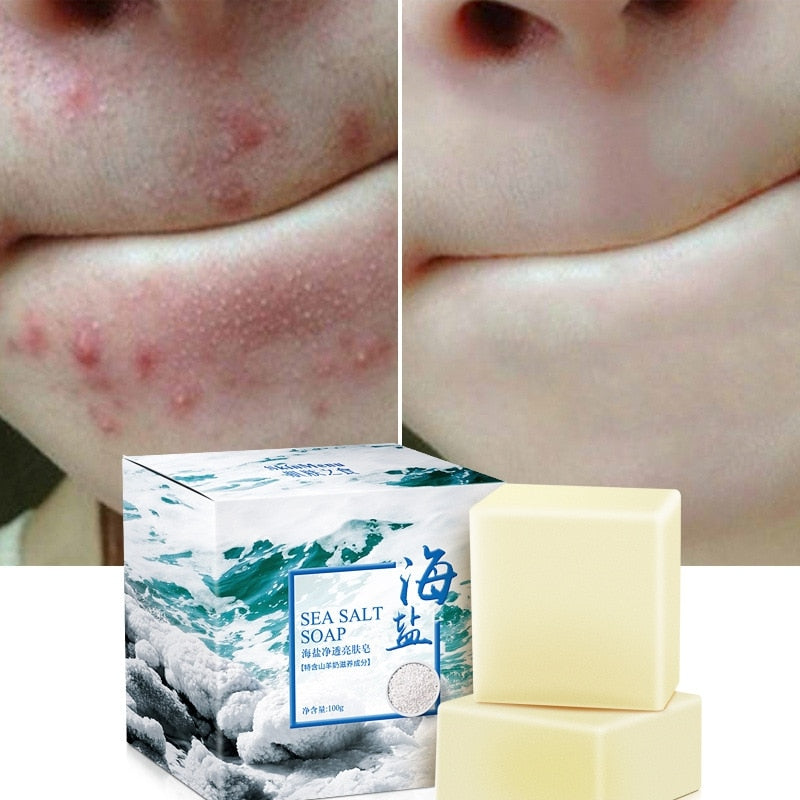 Sea Salt Soap Natural Advanced Wash Skin Whitening Soap