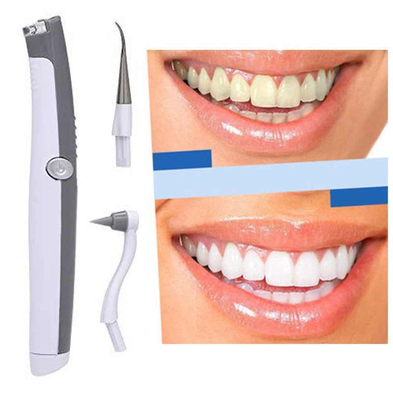 Electric Ultrasonic Tooth Stain Eraser